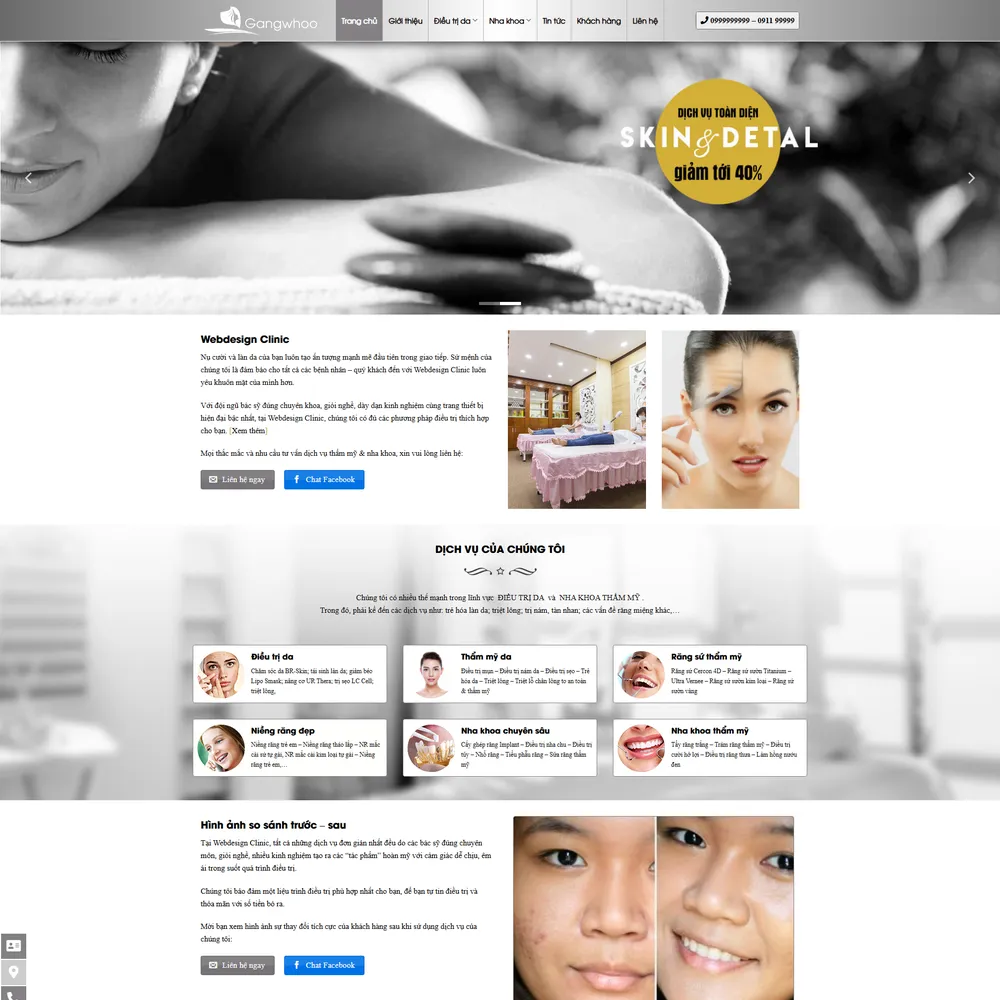 Mẫu website Spa Thẩm mỹ viện Gangwhoo
